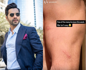 Varun Dhawan showcases ‘few of the many bruises’ he sustained