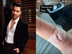 Varun Dhawan suffers injury, shows off deep cut on his finger
