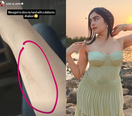 Adah Sharma hilariously ‘sliced’ her hand with ‘dabba ka dhakkan’