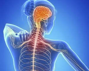New AI tool to track efficacy of multiple sclerosis treatments