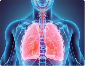 Study finds 1 in 3,000 people at risk of punctured lung from faulty gene