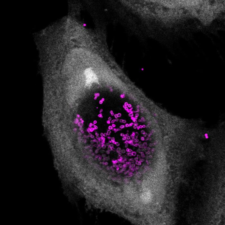 Researchers find molecule to kill sexually transmitted chlamydia
