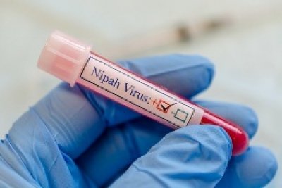 425 under surveillance as Kerala battles fresh Nipah virus outbreak