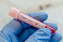 High-risk contact patient dies of Nipah in Kerala