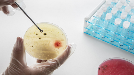 Targeted steroid use shows promise against TB