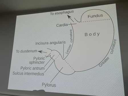 Metabolic surgery can help prevent organ damage, failure due to uncontrolled diabetes: AIIMS doctor