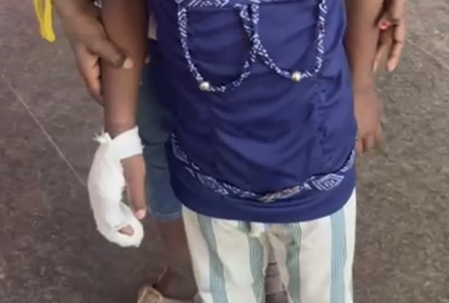 K’taka school mishap: FIR filed against BEO, teachers after Class 1 student loses fingers (Lead)