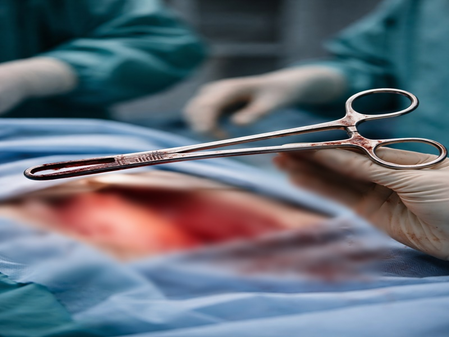 <div>Surgical forceps left in Kerala woman’s abdomen removed after five years</div>