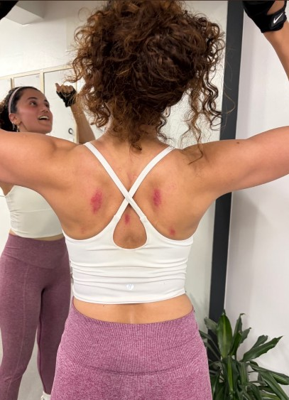 Taapsee Pannu shares glimpse of bruised back after working out on rough floor
